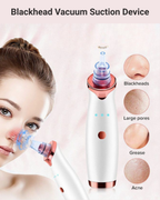 Blackhead Remover Device